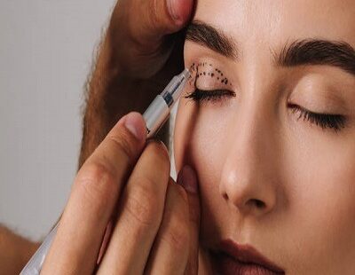 Eyelid Surgery in Riyadh 1 1