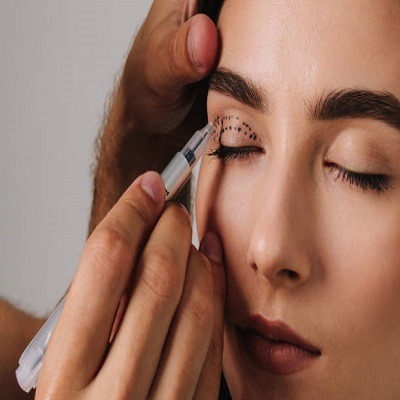 Eyelid Surgery in Riyadh 1 1