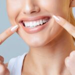 Professional Teeth Whitening Services