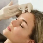 Radio Frequency Microneedling in Dubai