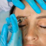 Anti-Wrinkle Injections in London: Costs, Results & What to Expect