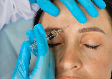 Anti-Wrinkle Injections in London: Costs, Results & What to Expect