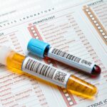 Private Blood Tests : What You Need to Know Before Booking