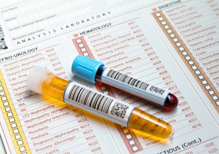 Private Blood Tests : What You Need to Know Before Booking