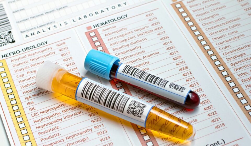 Private Blood Tests : What You Need to Know Before Booking