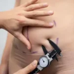 tummy tuck in lahore