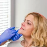 Dermal Filler Injections in Tampa for Natural Rejuvenation