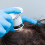 Man getting his scalp checked in a clinic