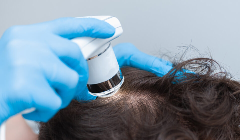 Man getting his scalp checked in a clinic