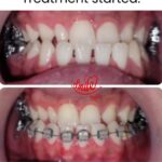 best dentist for dentures in Lahore