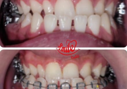 best dentist for dentures in Lahore