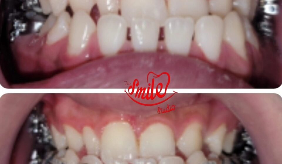 best dentist for dentures in Lahore
