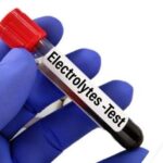 serum electrolytes test price