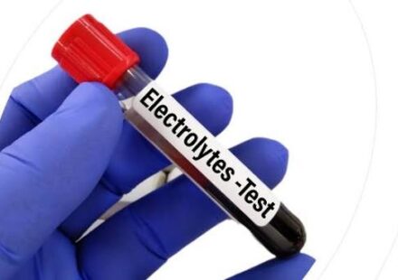 serum electrolytes test price