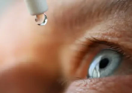 best glaucoma specialist in delhi