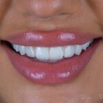 Dental Clinic Dubai