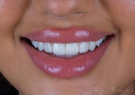 Dental Clinic Dubai
