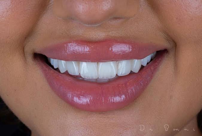 Dental Clinic Dubai