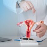 Endometriosis Treatment in dubai