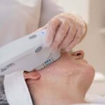 Ultherapy Dubai
