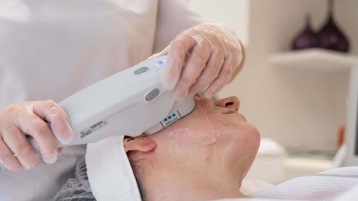 Ultherapy Dubai