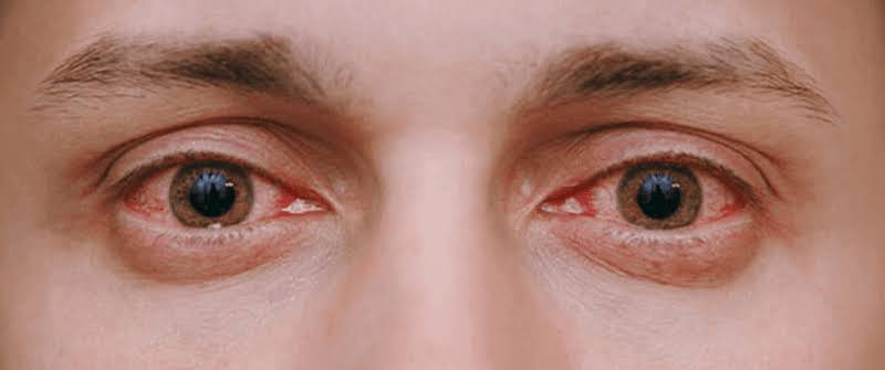 eye test at home in gurgaon