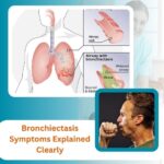 Bronchiectasis Symptoms Explained Clearly