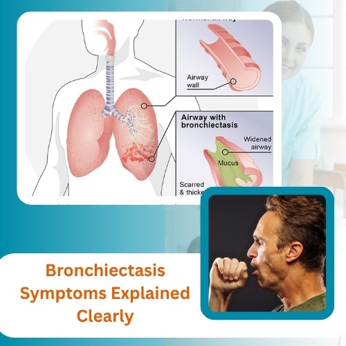 Bronchiectasis Symptoms Explained Clearly